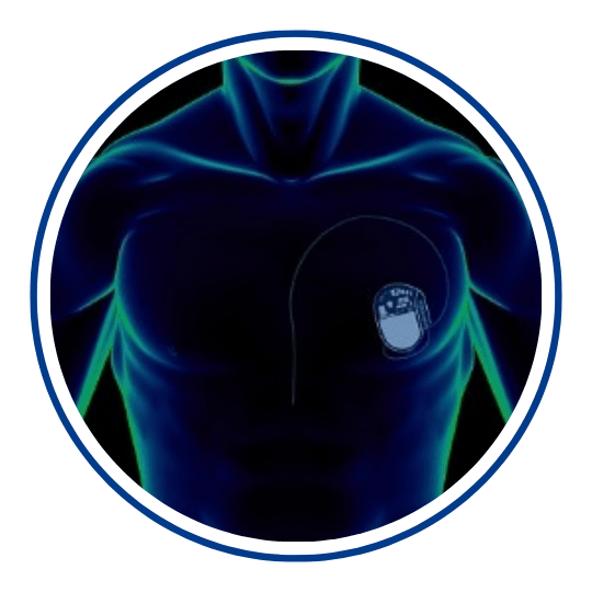 Icon Medical Device Approval Primer