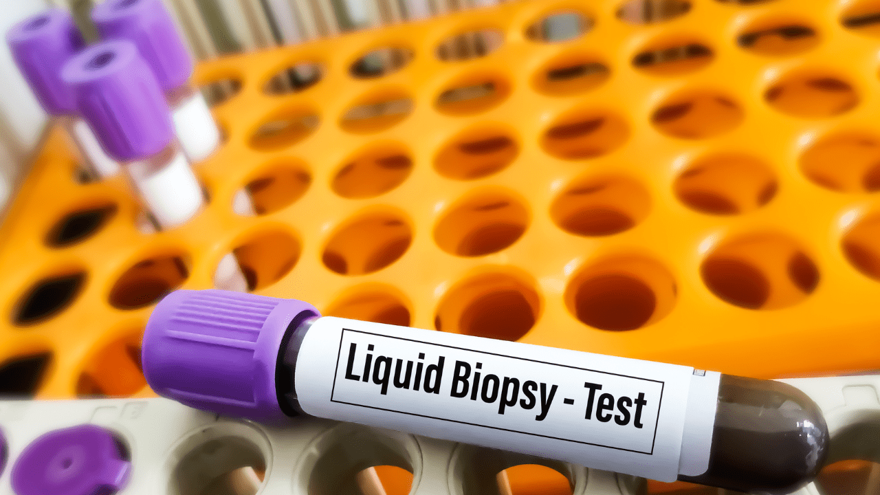 liquid biopsy collection vial